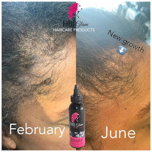 Anti Itch Scalp & Hair Growth Oil